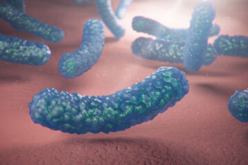 oral bacteria linked to brain clot mississauga dentist