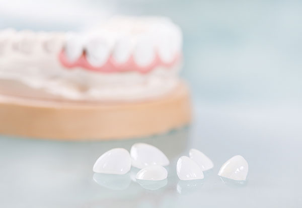 dental veneers peg shaped teeth treatment