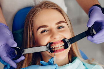 How to Care for Your Teeth While Wearing Dental Braces?