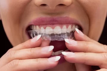 Invisalign for Teens vs. Adults: What’s the Difference?